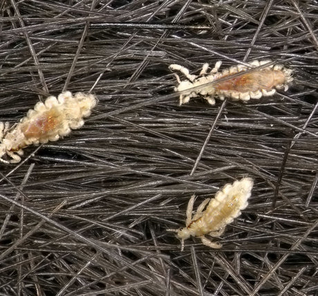 Head Lice Organic Control Information - Green Harvest
